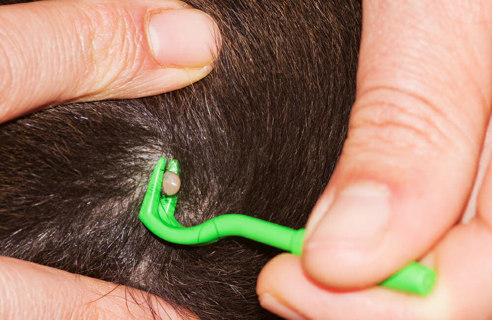 Hand removing tick on fur with tick remover tool